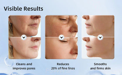 7 in 1 LED Light Therapy Facial Device